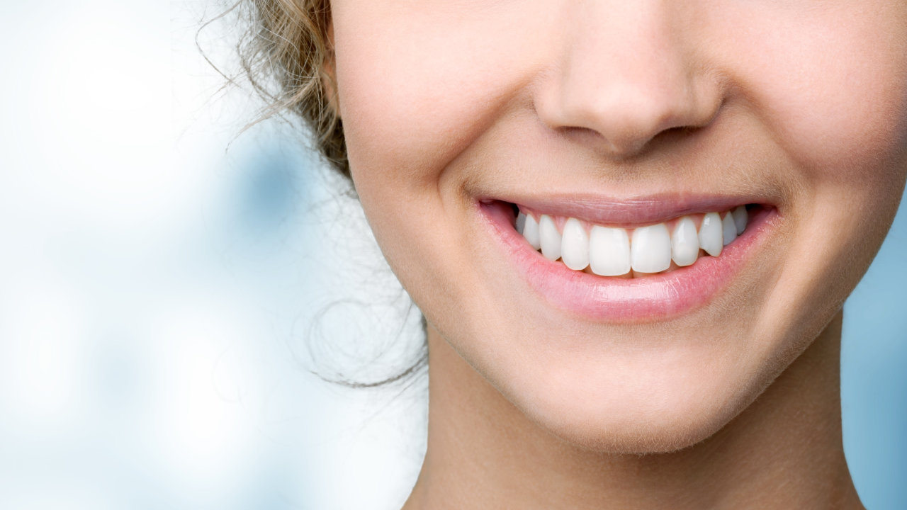 Close-up of a bright, white smile after cosmetic dental treatment