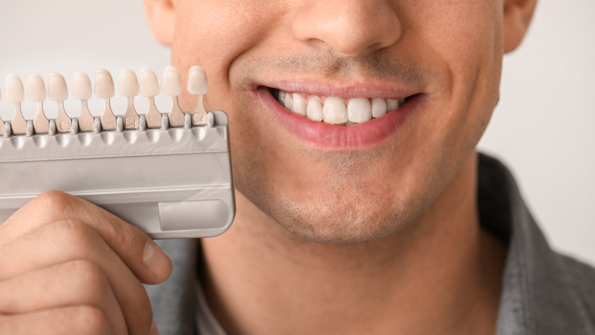 Smiling man with a dental shade guide held up to match veneer color to his teeth